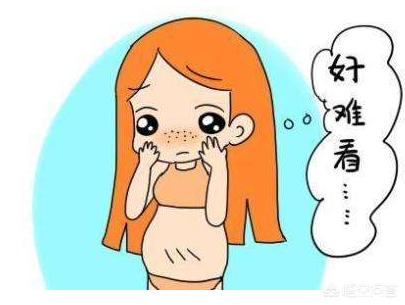 怀孕多久会长妊娠纹？为什么会长妊娠纹？插图37