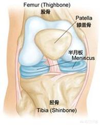 半月板损伤症状:半月板损伤症状的表现 半月板损伤了的话，还适合做深蹲吗？