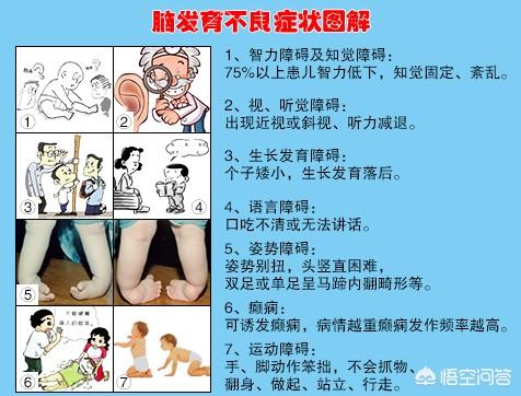 脑性瘫痪:脑瘫和脑发育不全到底有什么区别？