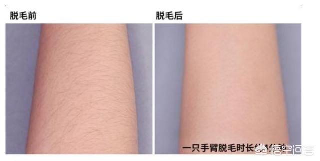 给b脱毛:如何快速脱毛？有哪些小妙招？