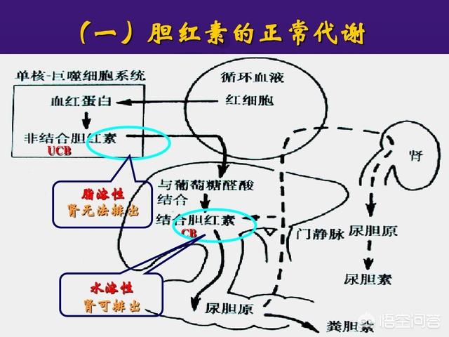 头条问答 检查多次 直接胆红素 高是什么原因导致的 14个回答