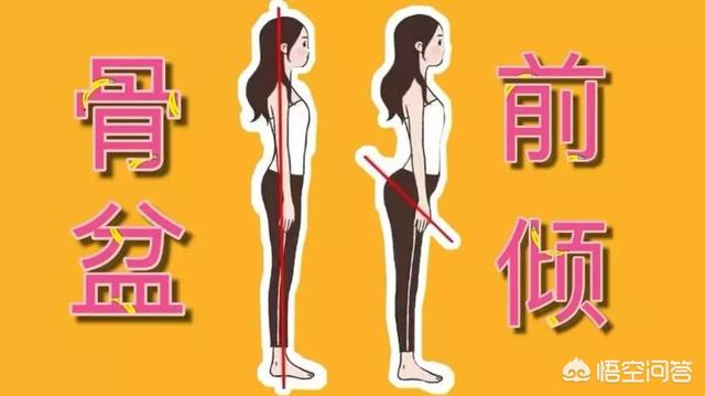 用什么器械,锻炼哪里的肌肉可以改正骨盆前倾？
