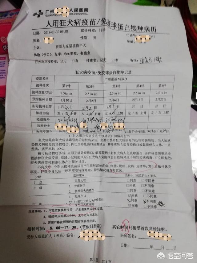 猫咖被猫抓了一下轻微破皮要打针吗:小朋友被小猫抓伤了，破点皮，该不该去打疫苗？