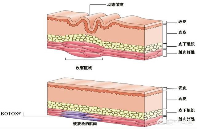 怎么治抬头纹(怎么治抬头纹视频)