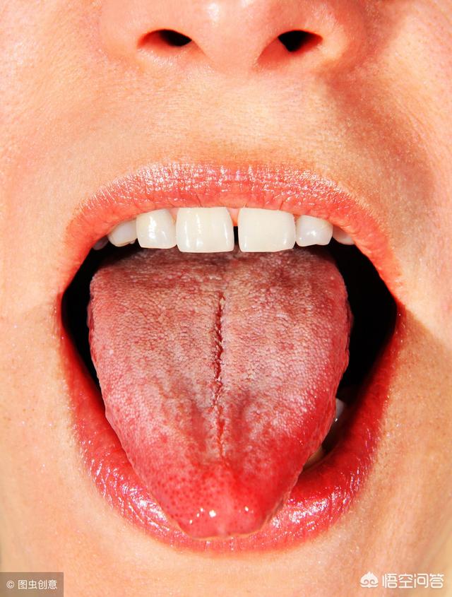 如何调理湿热体质 营养师吴斯洁的回答 头条问答