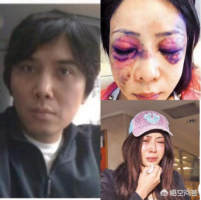 佟丽娅家暴:娱乐圈有哪些被家暴的女明星？