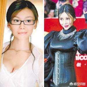 郎朗巩新亮:怎样看待明星整形现象，你赞成还是反对