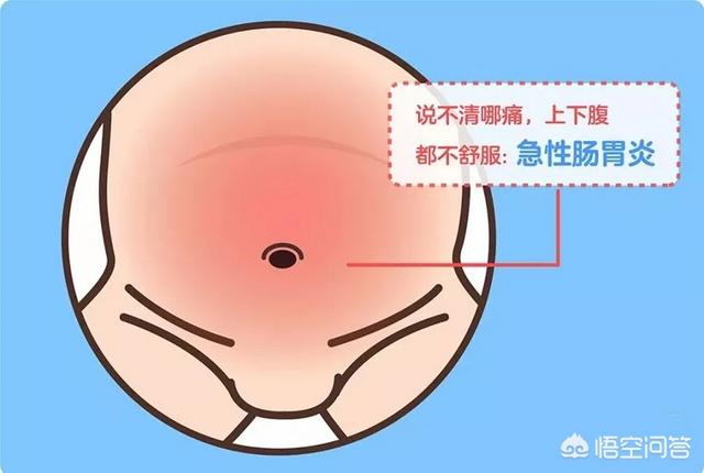 宝宝肠梗塞是怎么引起的:小婴儿肠套叠是什么引起的？