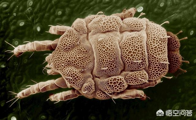 头条问答 - 从后背痘痘里面挤出来的东西也是螨虫粪便吗?