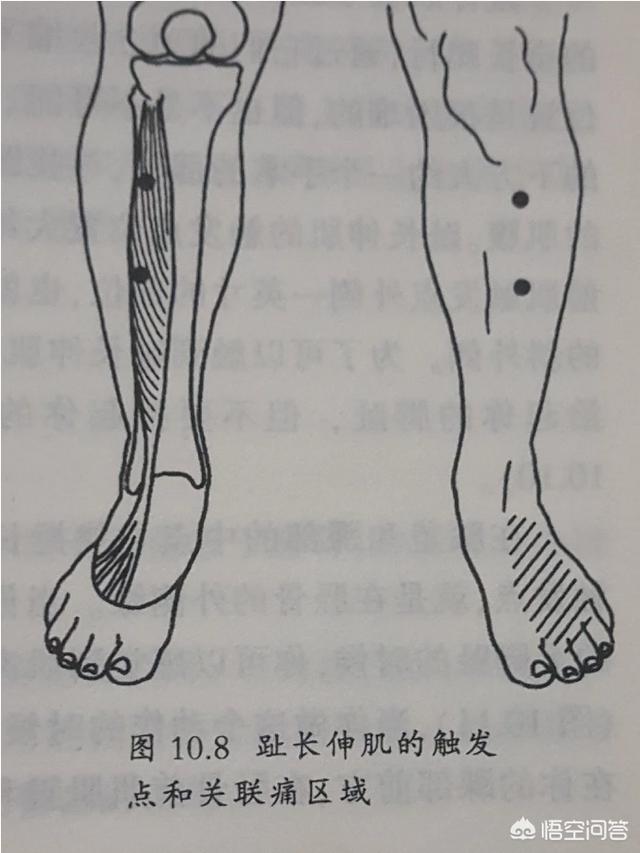 脚麻怎么回事-脚麻是什么原因引起的,怎么解决