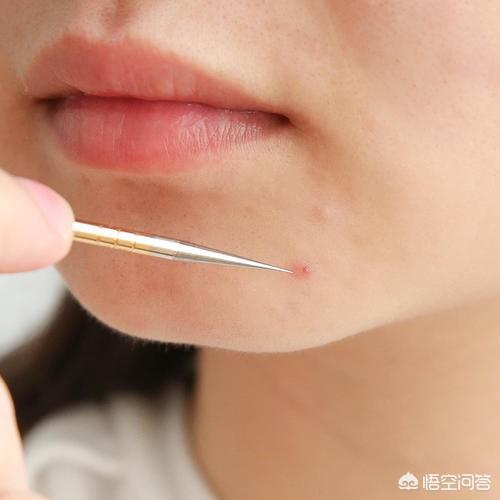 如何收缩鼻头毛孔(鼻头上的毛孔洞怎么收缩)