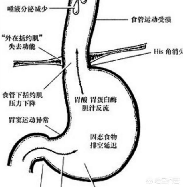 胃痉挛什么症状,胃痉挛什么症状吃什么药缓解