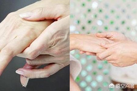 末梢神经炎:神经末梢炎的症状是什么？