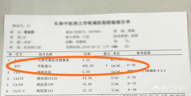 头条问答 验血能查出癌症吗 110个回答
