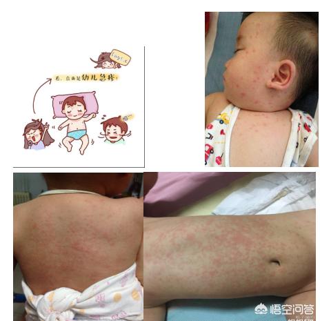 孩子发烧温度升得快:小孩没有感冒症状，怎么就发高烧了？