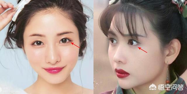 孙俪整容:大家对现今文艺界，尤其是女演员们整容怎么看