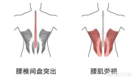 头条问答 腰肌劳损 有什么缓解方式吗 沧海人间的回答 0赞