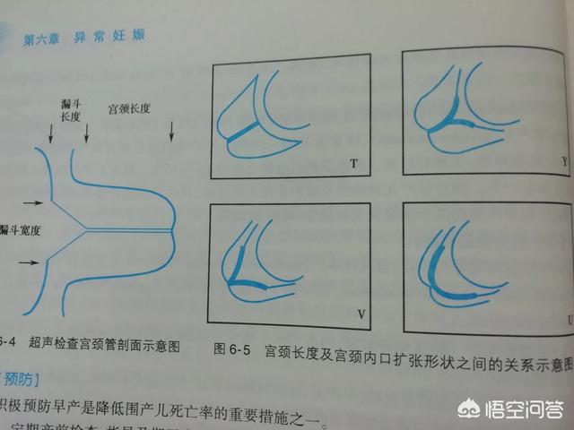 为什么能摸到宫颈长长的,为什么有时候能摸到宫颈