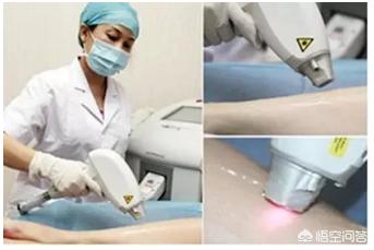 给b脱毛:如何快速脱毛？有哪些小妙招？