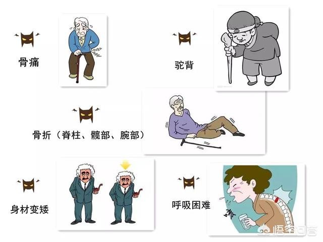 骨质疏松和缺钙的原因:吃了多年钙片为何还缺钙？