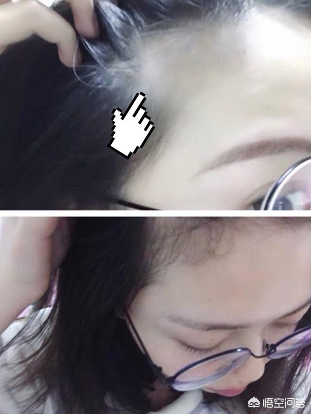 育发液，中国的康王好还是日本的柳屋好？