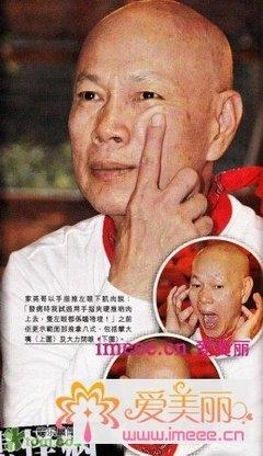 田震什么病:娱乐圈中有哪些明星看起来风光无限，实际上却“怪病缠身”？