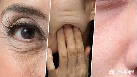 内部原因:随着年龄的增长,皮肤的保湿和屏障功能逐渐减弱;脸上有细纹