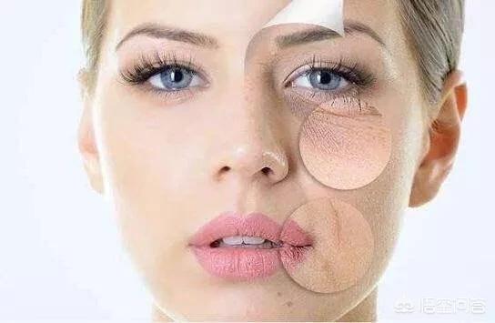 眼部有细纹(眼部有细纹用眼霜还是眼精华)