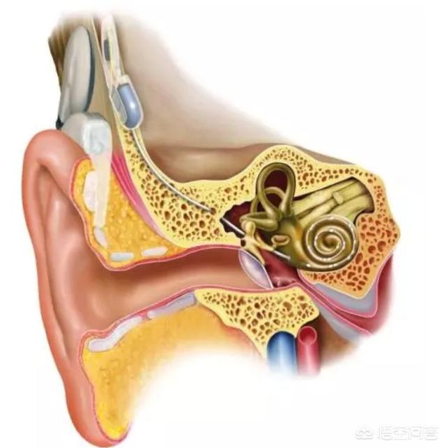 耳朵疼一只耳朵失聪:耳朵进水了会导致耳朵失聪吗 单耳耳聋，戴助听器有帮助吗？