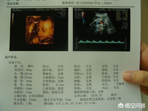 b超对胎儿的影响：做彩超对胎儿有影响吗