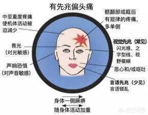 好端端的为什么偏头疼，偏头痛的原因及缓解方法？