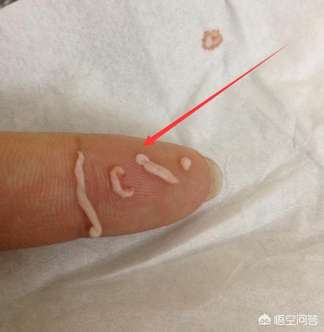 花清丹滋养型有排泄物:女性一般多少岁绝经？绝经前，身体会出现什么“异常”？