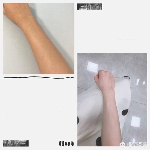 美白针效果怎么样(医院打美白针有效果吗)