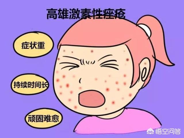 黑棘皮症后果严重吗:都说多囊会引起肥胖、月经推迟、长痘痘，还有什么其他症状吗？