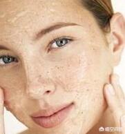 肌肤粗糙暗沉是因为什么原因，皮肤粗糙，毛孔粗大是怎么回事