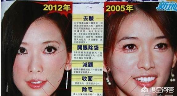 朴智妍承认整容:林志玲整容前是什么样子？