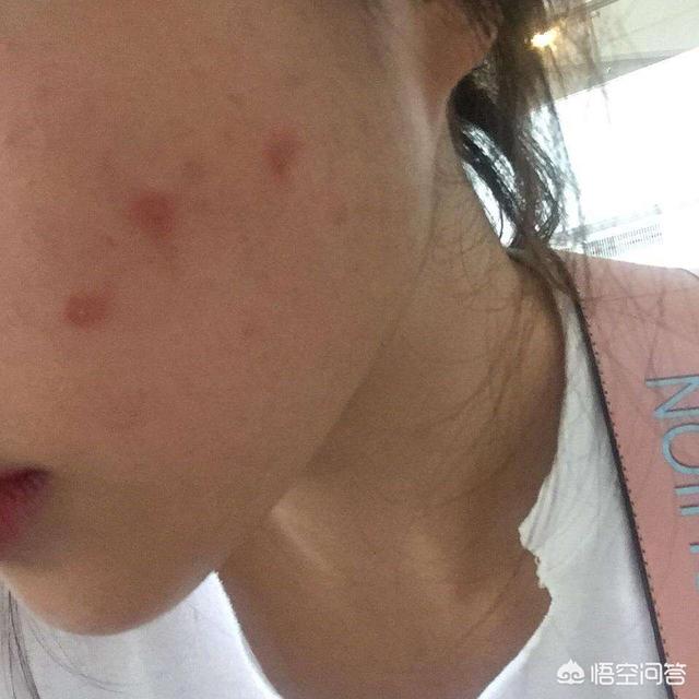 赛维洛犬菌清哪里有卖:养猫人都会有猫藓么?养猫会被猫传染猫癣吗？