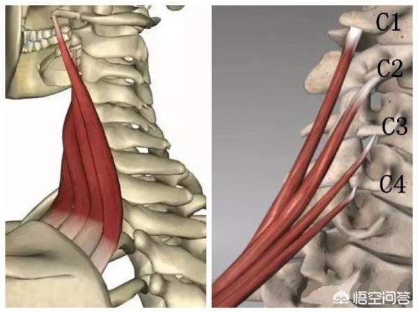 脊柱扭的地方有按压式的疼痛：脊柱扭了一下有刺痛