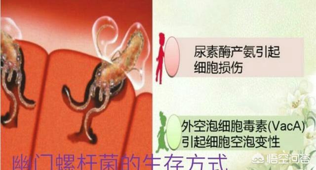 有哪些食疗法能够不用去医院,抑制幽门螺杆菌感染？