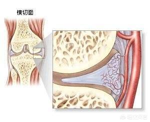 半月板损伤症状:半月板损伤症状有哪些 膝盖半月板损伤还能治好吗？