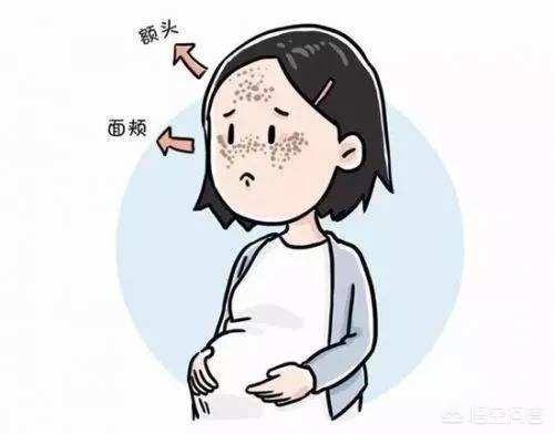 怀孕多久会长妊娠纹？为什么会长妊娠纹？插图16