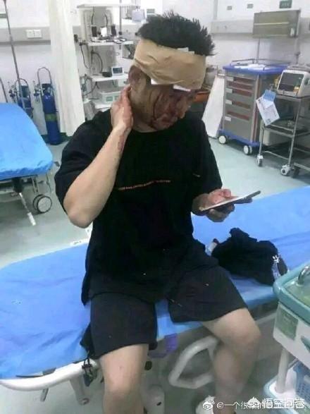 斗鱼钱小佳惨遭“爆头”，头破血流仍坚持直播，作案者遭到死亡通缉，如何评价此事？
