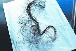 神农架野人:神农架野人目击地是否存在？神农架野人图片是真的吗？