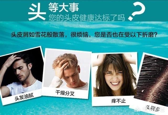 可不可以帮我推荐一个比较好的去头皮屑的洗发水,有哪些？