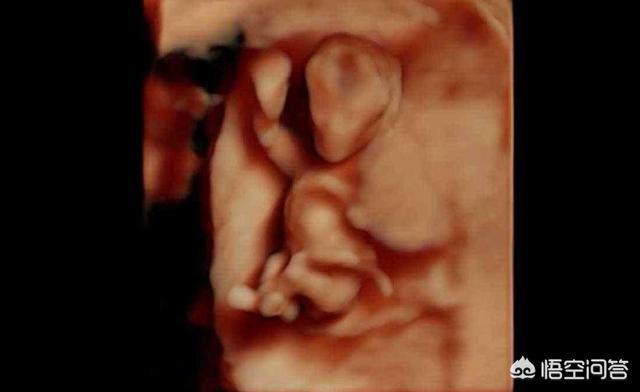 孕3个月的胎儿宝宝有多大？孕妈妈身材比较瘦，没有显怀正常吗？