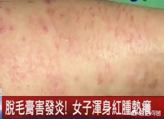 永久脱毛:脱毛膏有能永久脱毛的吗？