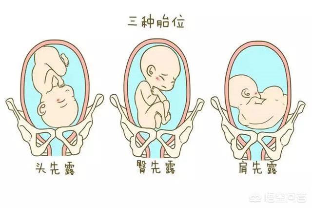 头条问答 - 胎心在肚脐左下方是什么胎位?(10个回答)