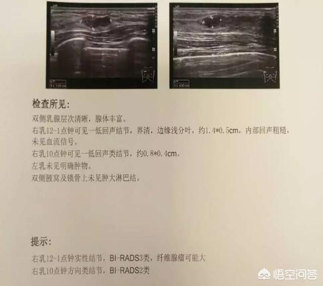 头条问答 - 乳腺彩超报告怎么看?(9个回答)