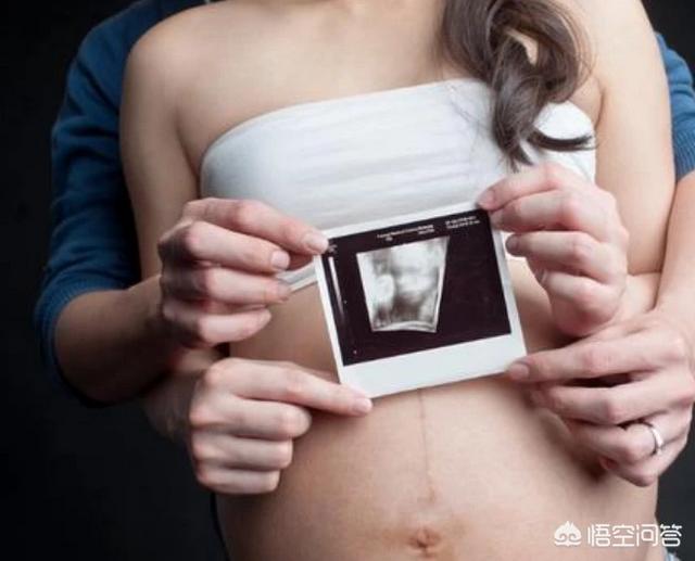 女孩肚子里有老鼠:怀孕后，为啥肚子上会有条黑线？对胎宝有影响吗？如何去除？