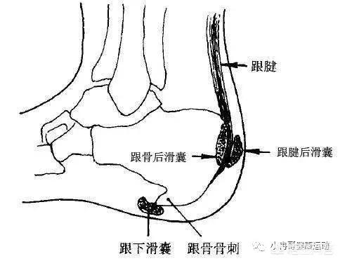 女生尾巴根疼是什么原因:男孩尾巴根疼是什么原因 引起足跟痛的原因是什么？